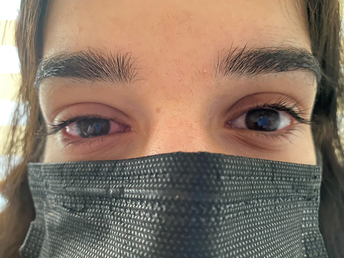 simdi-de-gozlerde-virus-salgini-uzmanlar-adenoviruse-karsi-uyariyor-7056-dhaphoto3-copy