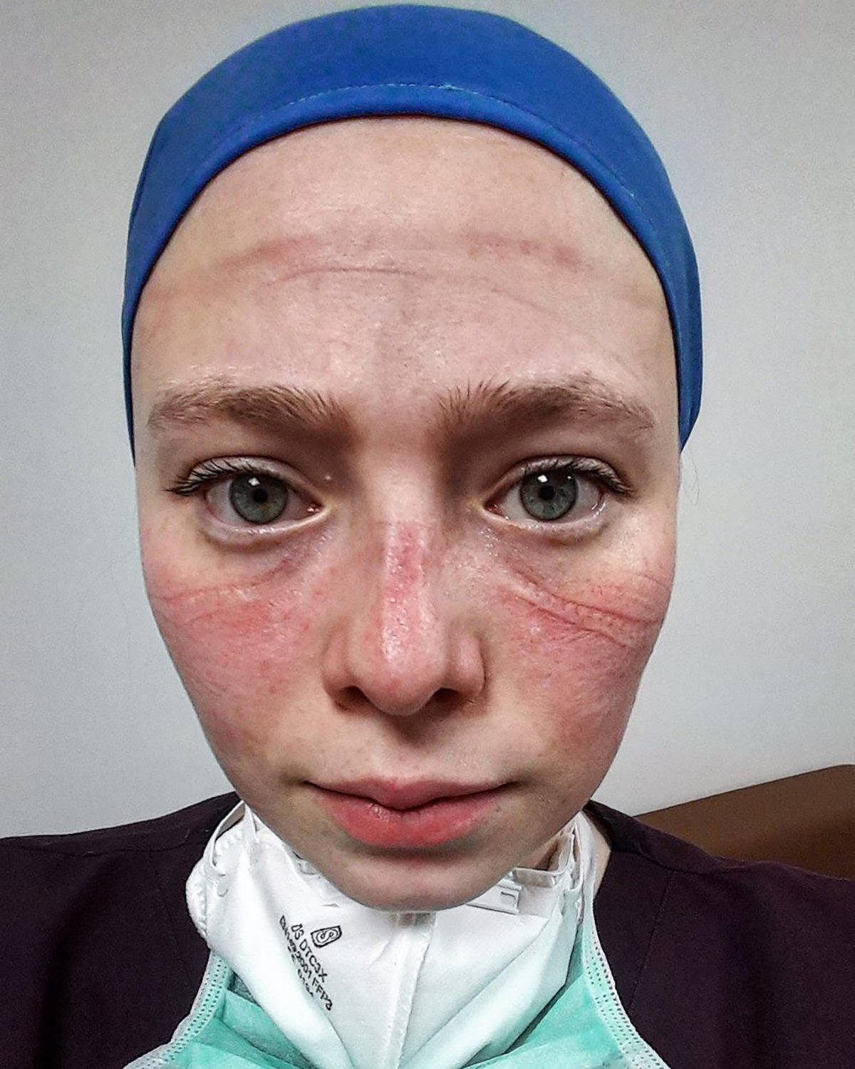 cabfd00865a73606aaa25c85639a6c5b-1-001