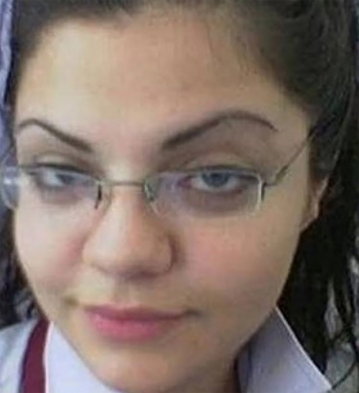 hilal-altinbilek-estetik