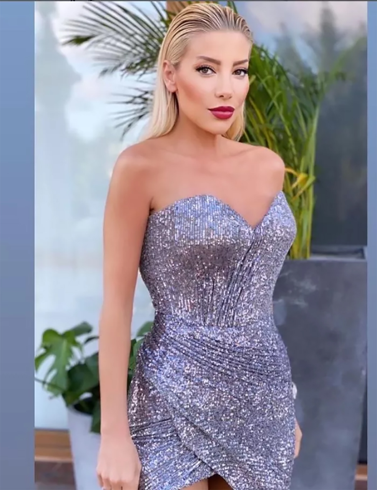 gulsah-saracoglu-estetik-ameliyat