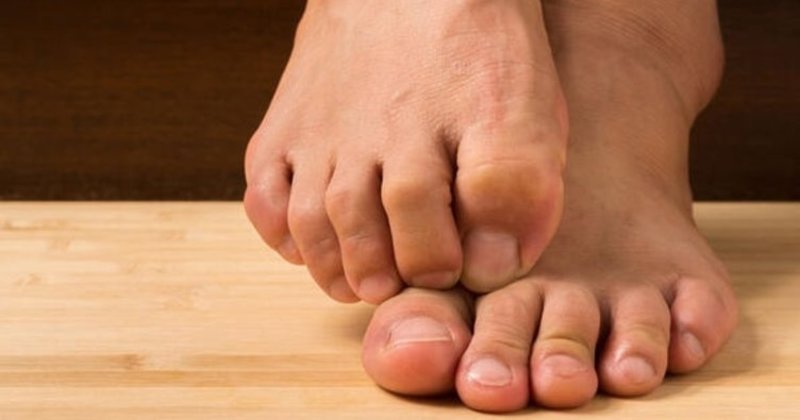 800x420-ayak-mantari-nasil-gecer-ne-iyi-gelir-ayak-basparmak-tirnak-mantari-tedavisi-1621336182420