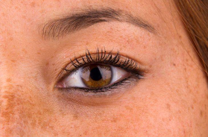 cemiplimab-skuamoz-yassi-hucreli-cilt-kanseri-immunoterapi-56234-730-480