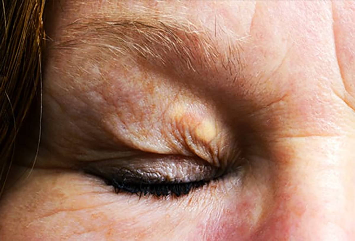 yuzunuz-ve-hastalik-10