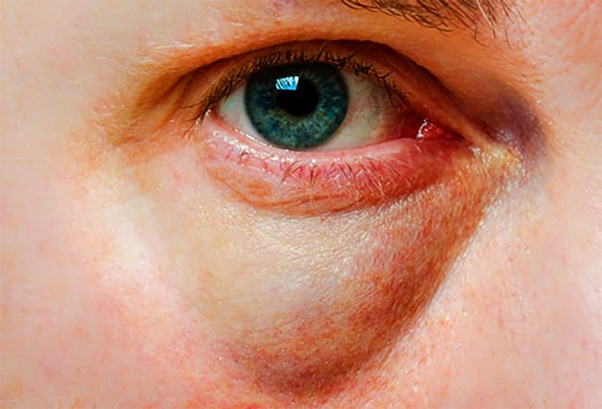 yuzunuz-ve-hastalik-11