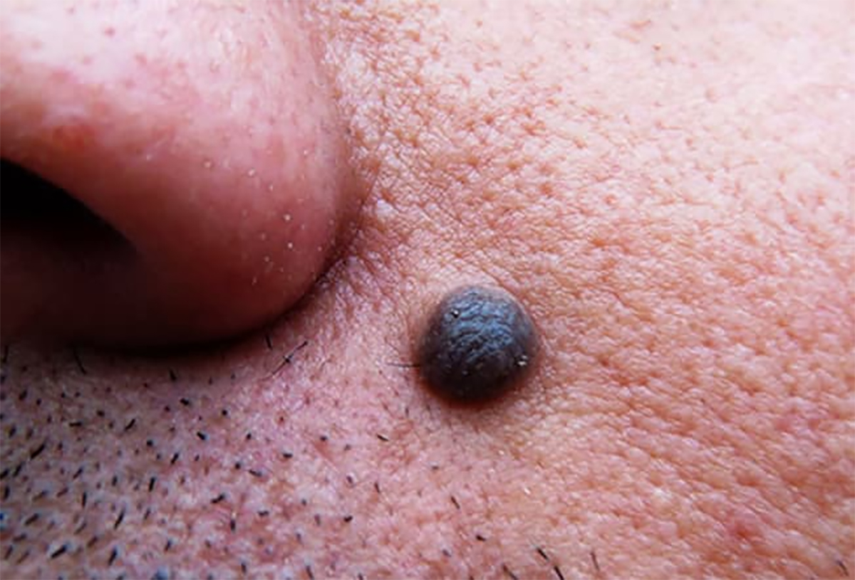 yuzunuz-ve-hastalik-2