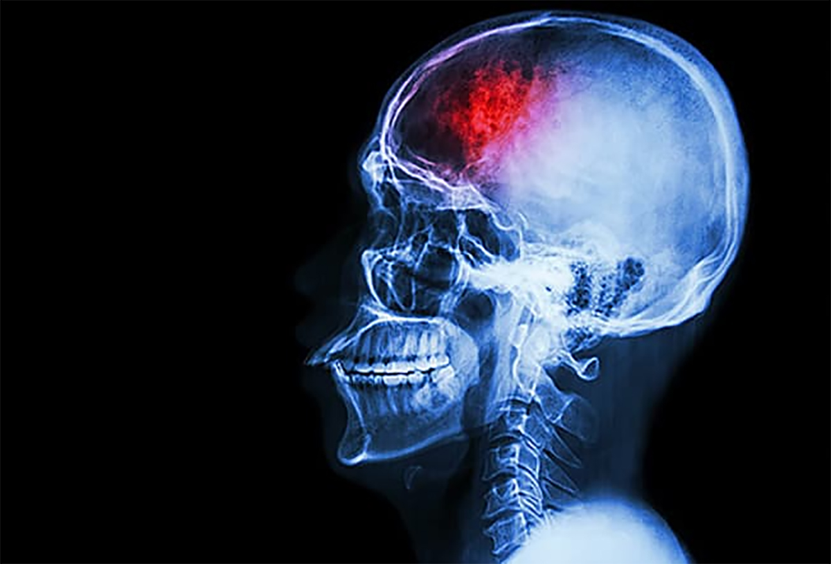 yuzunuz-ve-hastalik-9