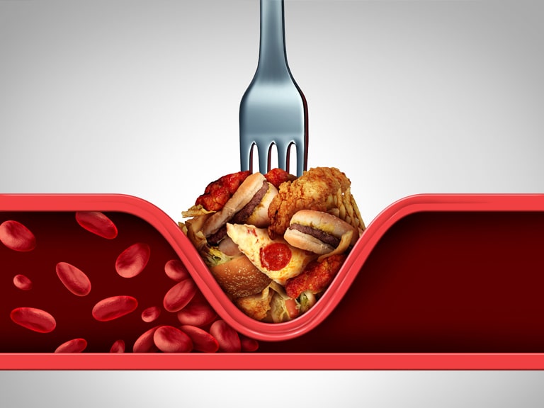 kolesterol-ve-beslenme-min