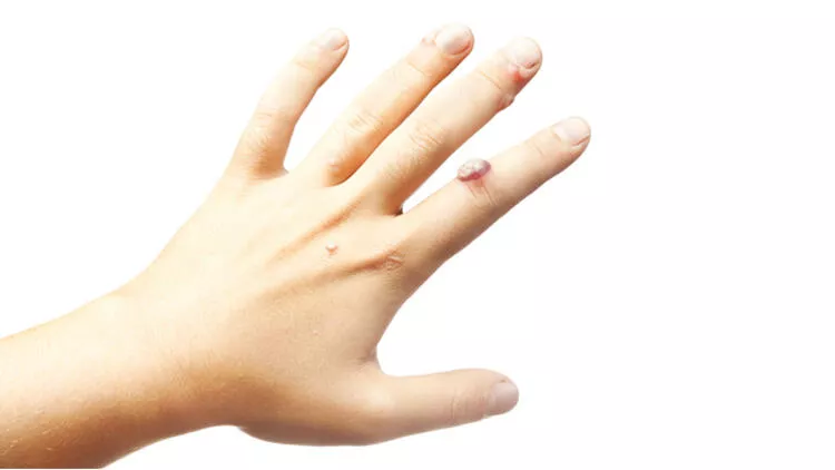 5fc9ef2367b0a913307d8ade