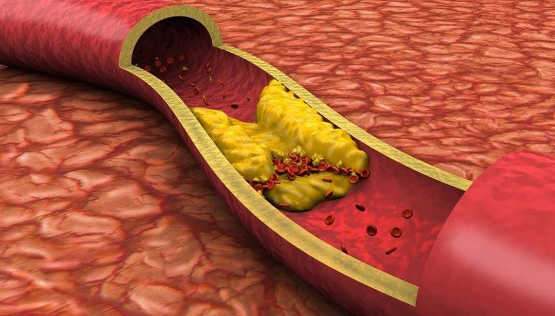 baia0bkpy0a3lzrt8zip-w