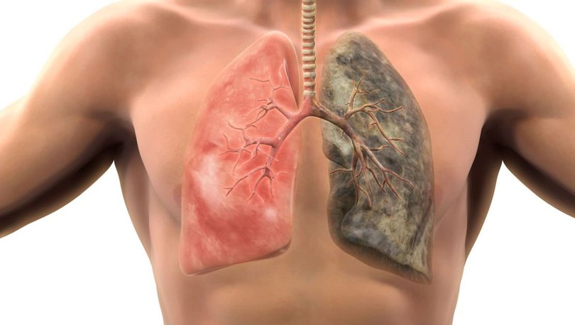 sigaranin-sagliga-zararlari-nelerdir-2531710-810x458