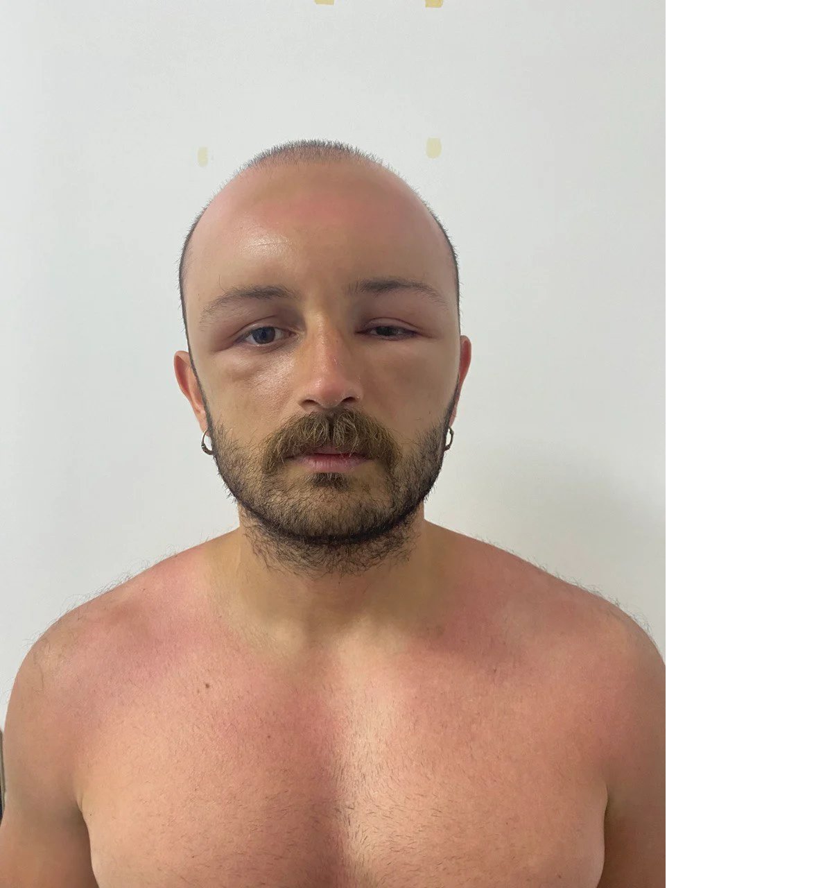 121346128-2-gun-plaja-gitti-basinda-nadir-gorulen-sicak-odemi-olustu-2