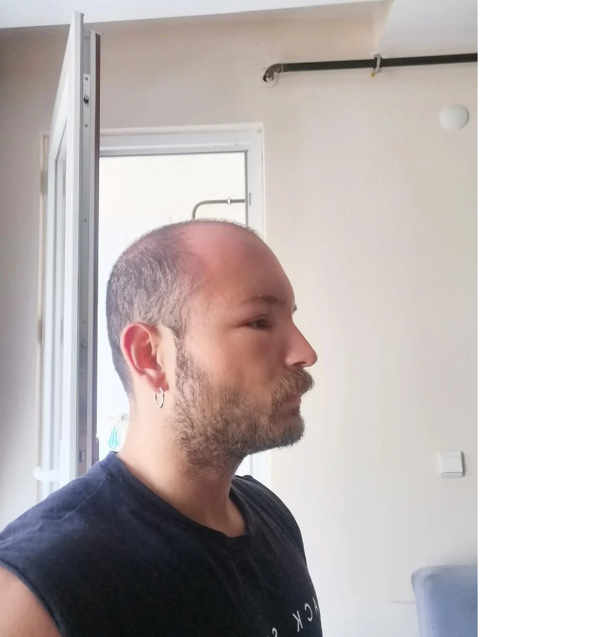 121348200-2-gun-plaja-gitti-basinda-nadir-gorulen-sicak-odemi-olustu-5