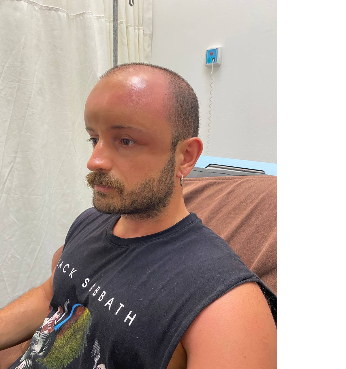 121349287-2-gun-plaja-gitti-basinda-nadir-gorulen-sicak-odemi-olustu-7