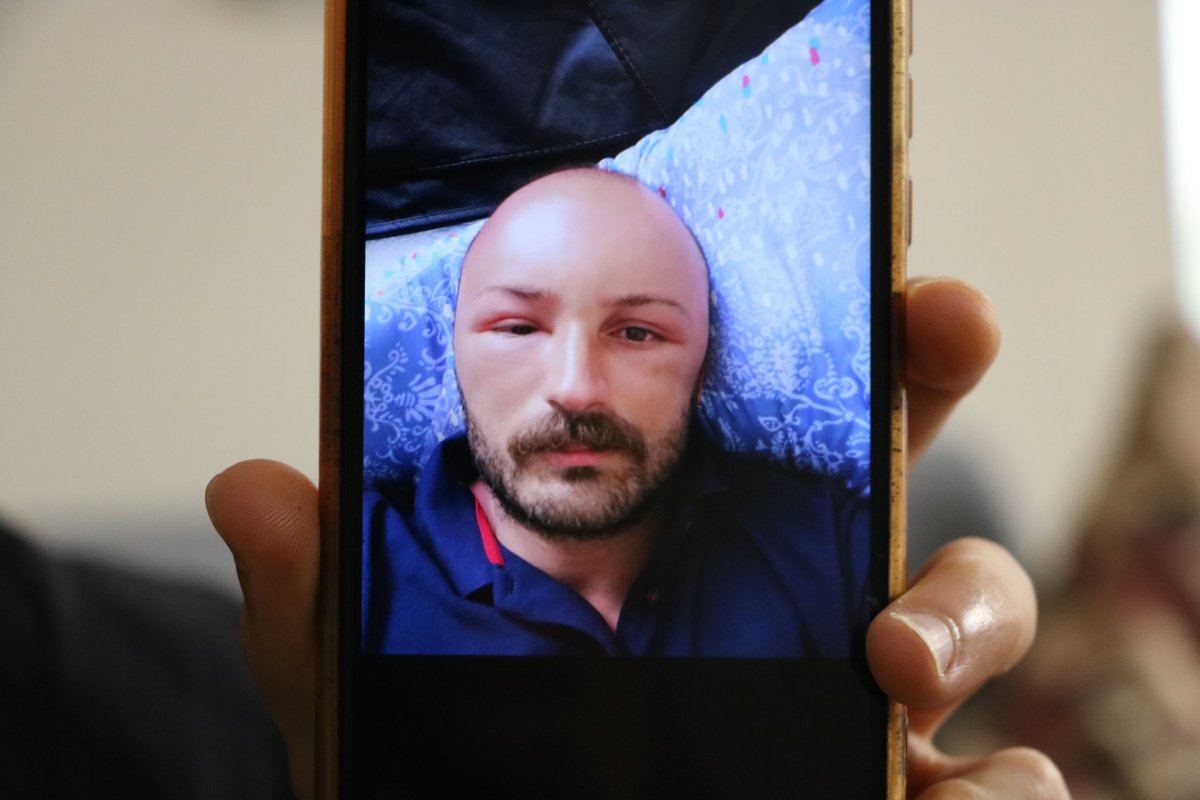 121349427-2-gun-plaja-gitti-basinda-nadir-gorulen-sicak-odemi-olustu-8