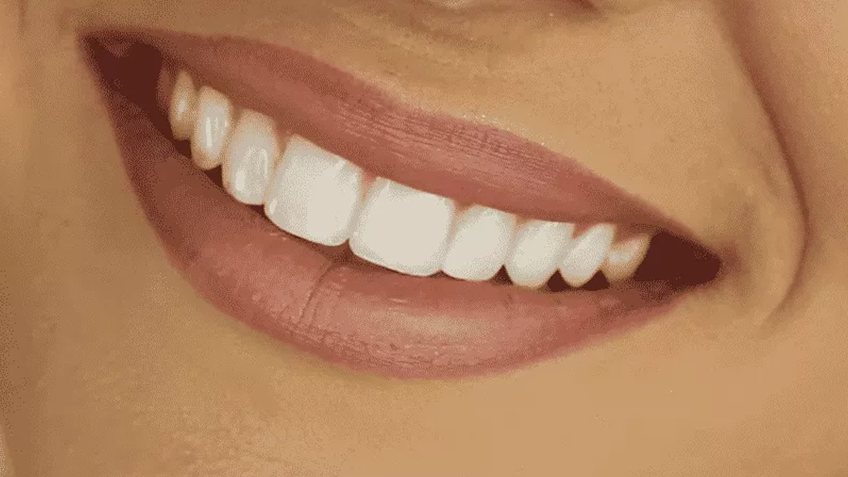 зубы красивые фото женщин улыбки