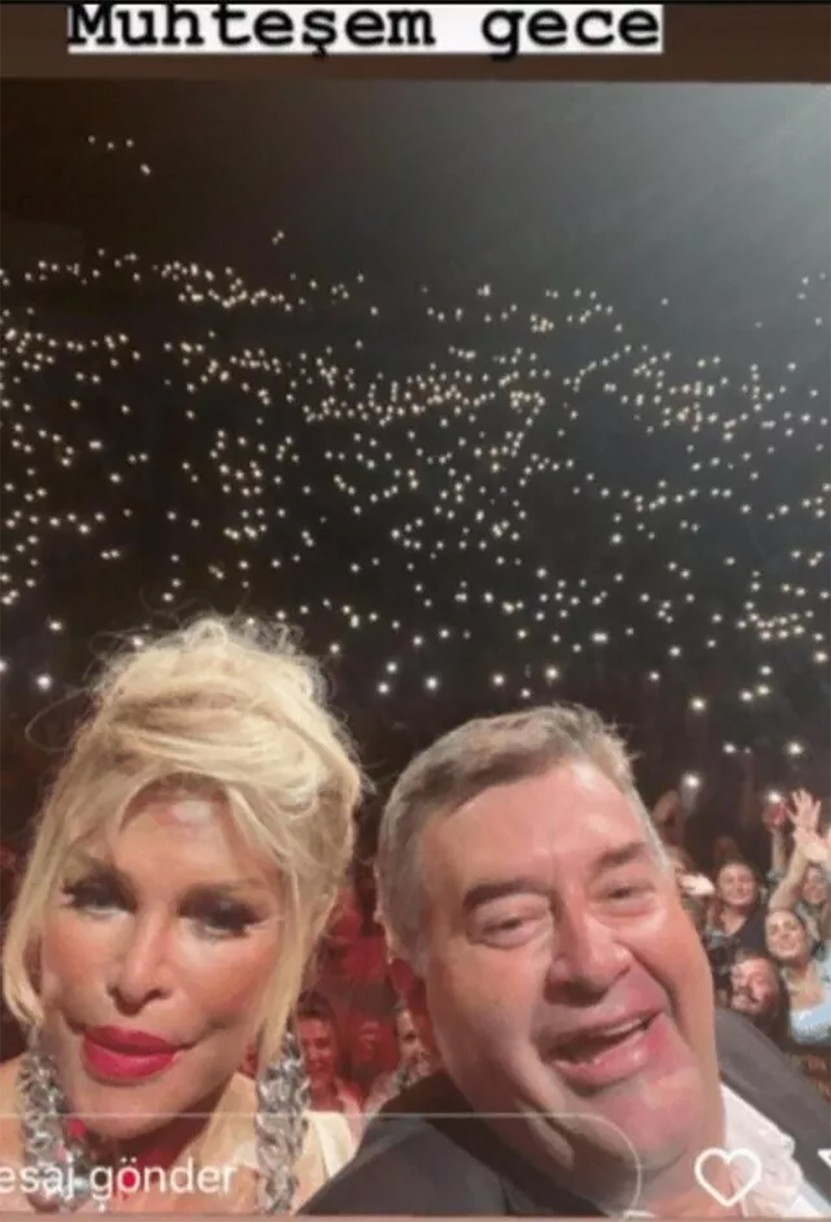 ajda-pekkan-estetiksiz