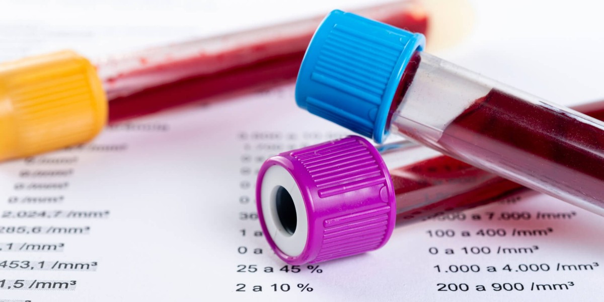 BETA HCG Testi nasıl yapılır