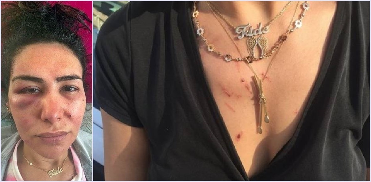 adana-evde-saldiri-2