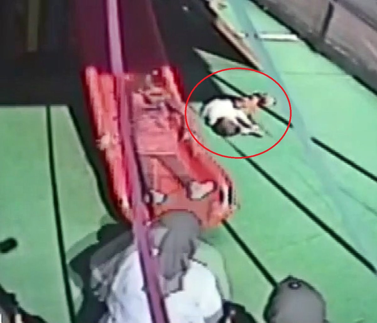 ankarada-kresten-cocuk-beyin-kanamasi-gecirdi-4