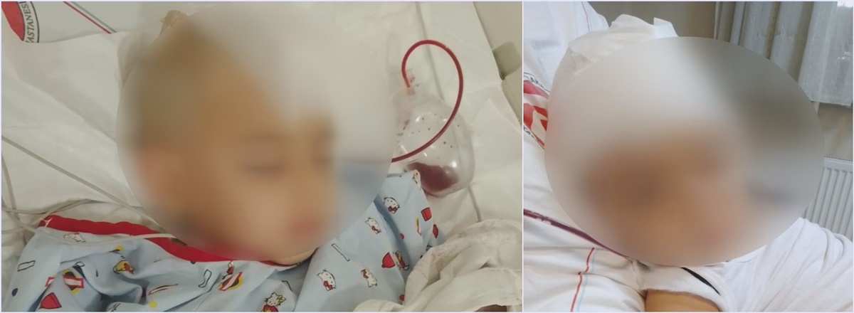 ankarada-kresten-cocuk-beyin-kanamasi-gecirdi