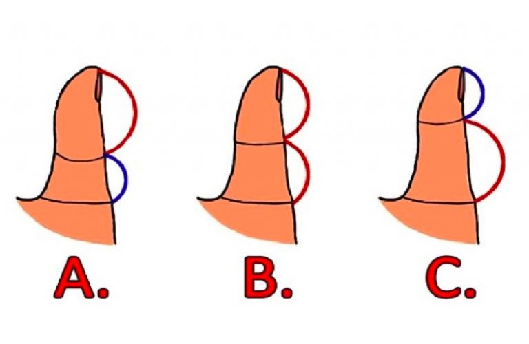 thumb1-768x500.jpg