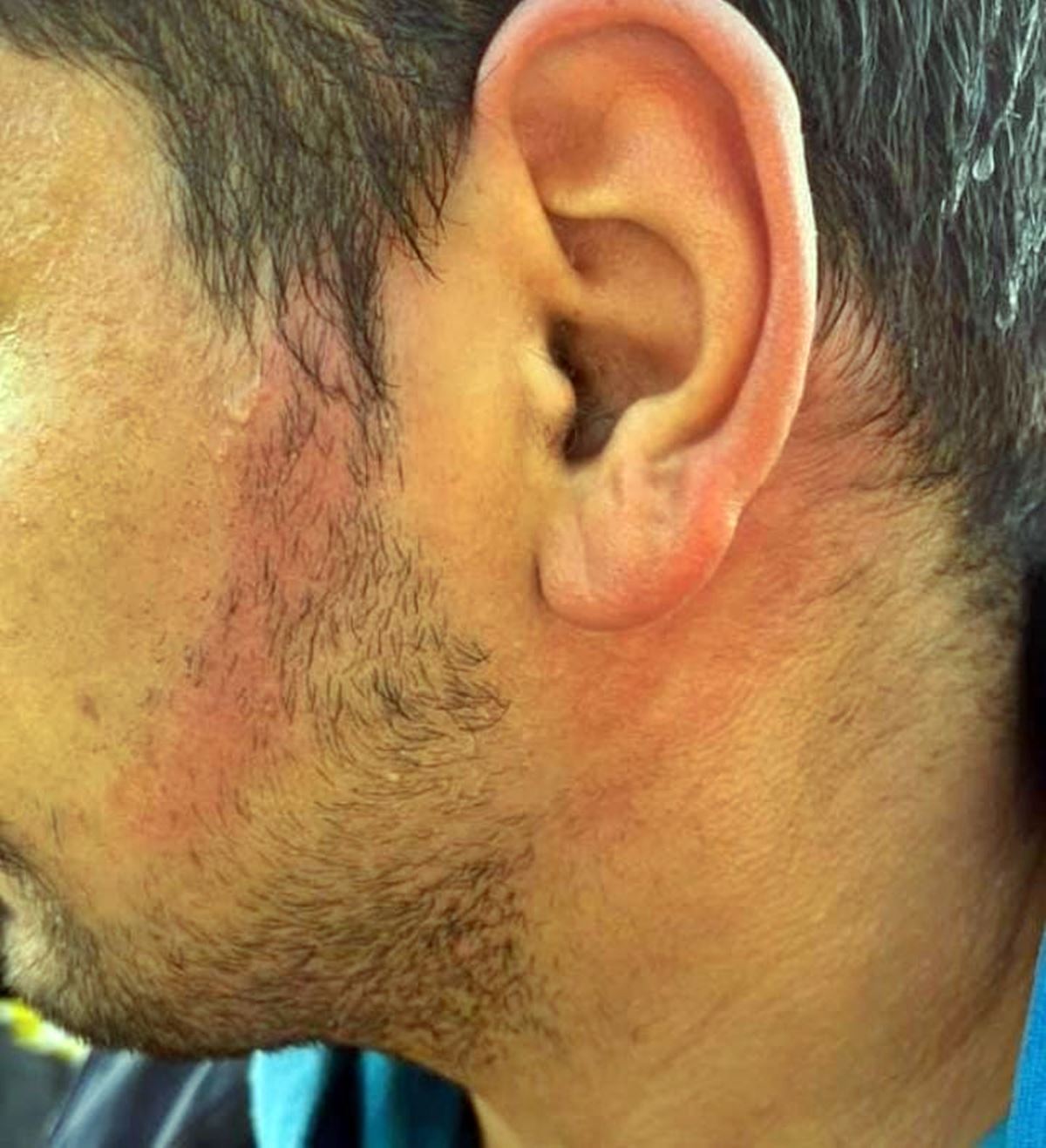 istanbul-umraniye-trafik-kazasi