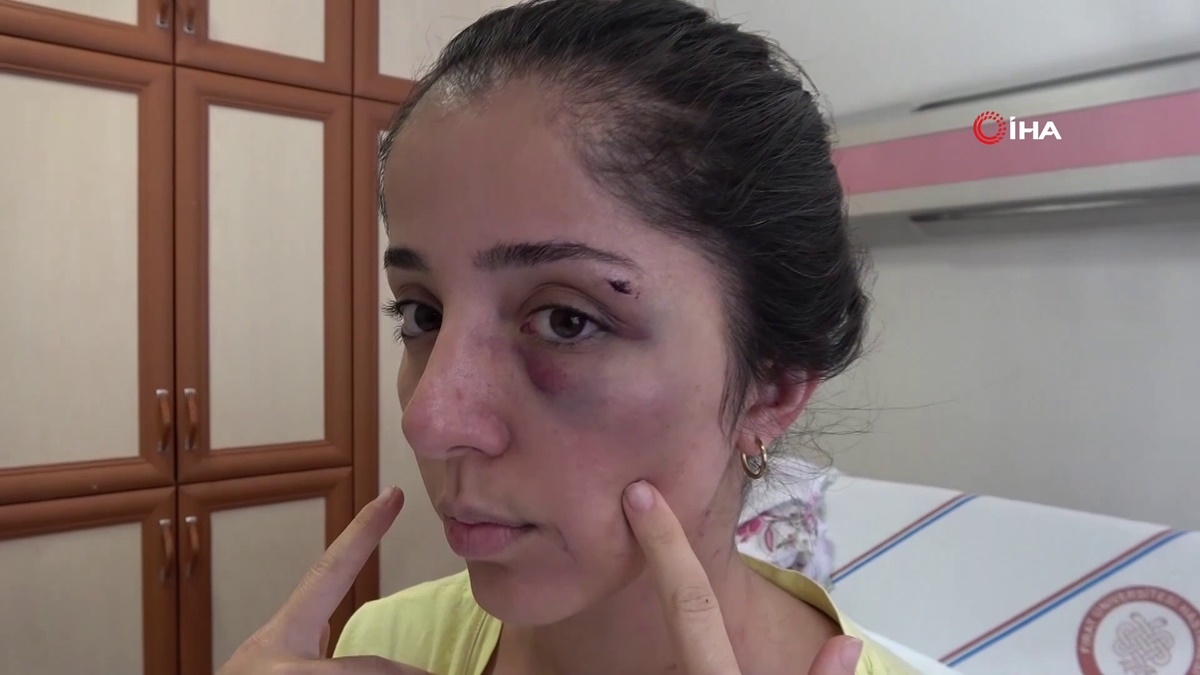 elazig-sevgilisini-bicaklayan-doktor-haberi-31