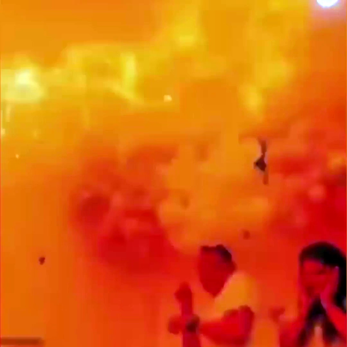 cinsiyet-partisinde-helyum-dolu-balon-alev-aldi-4