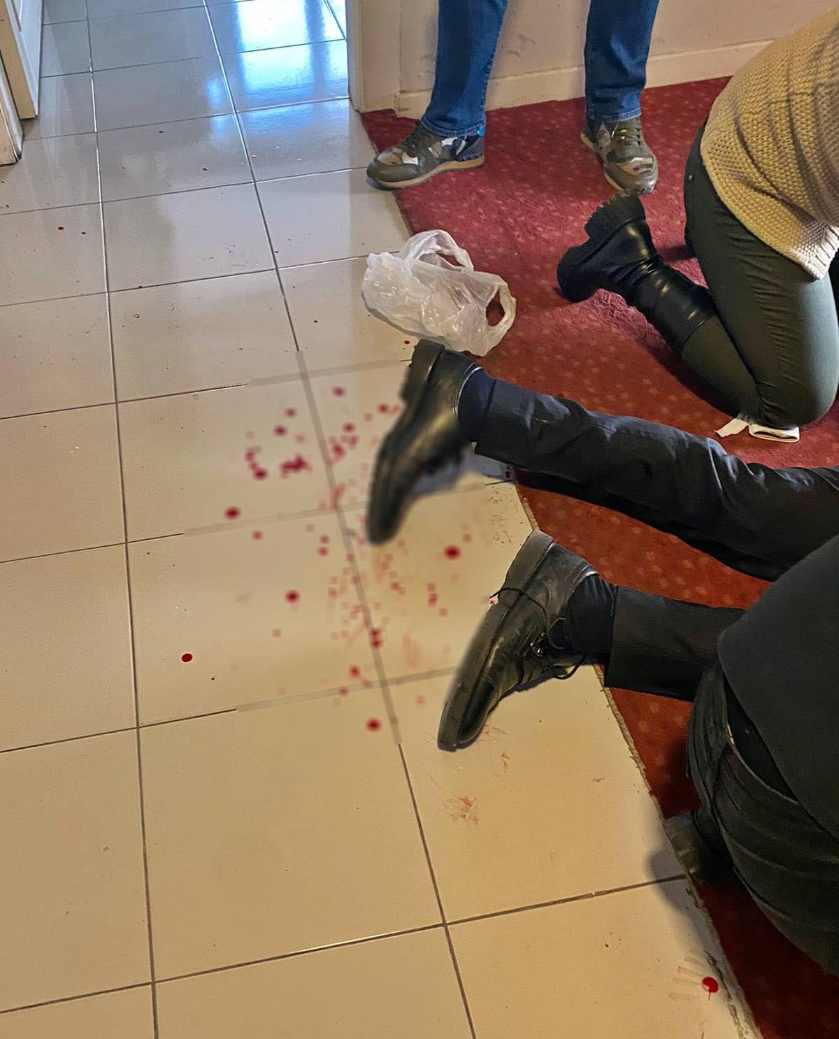 ozturk-yilmaz-bicakli-saldiri-5