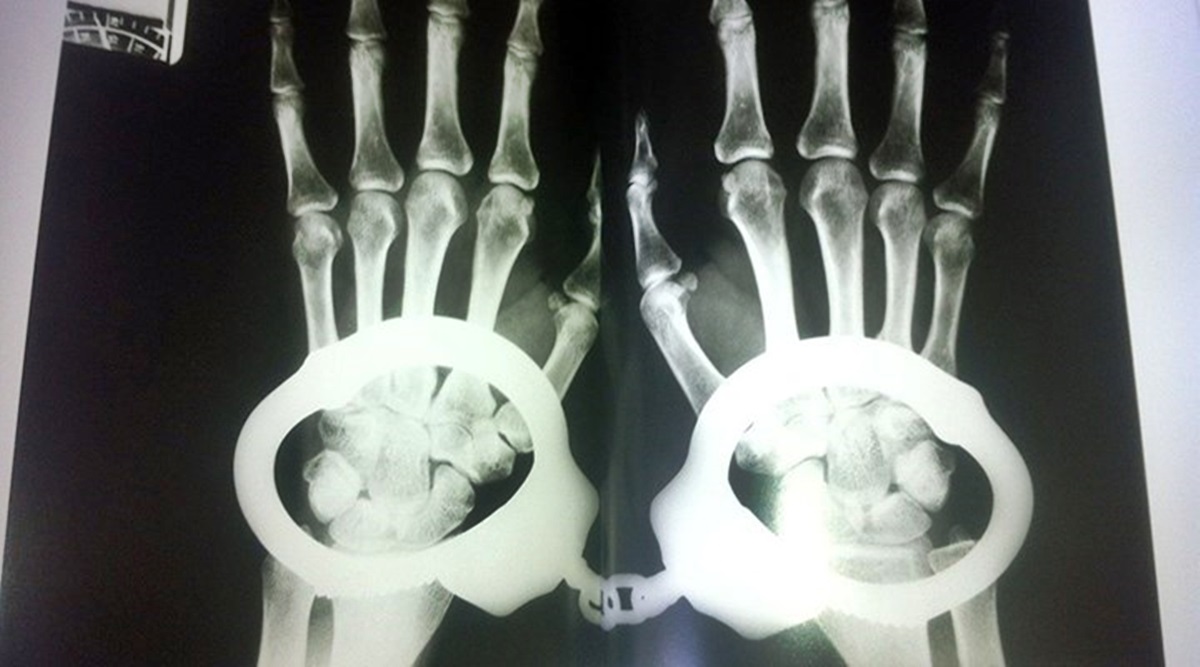 mucella-yapici-kelepceli-muayene-1