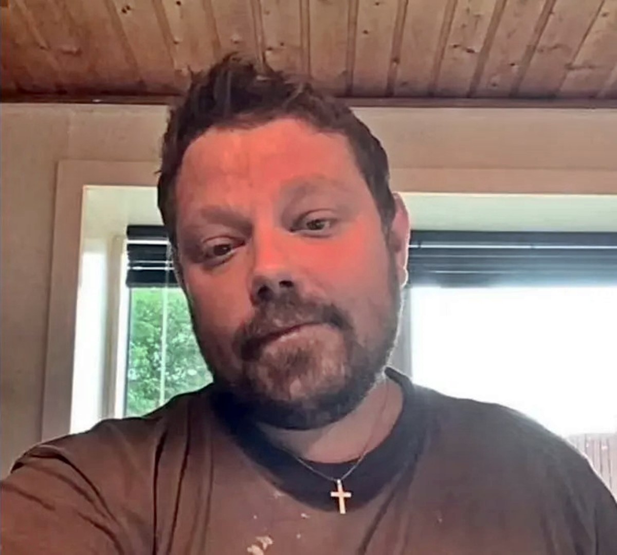 kedinin-isirdigi-adam-oldu-1