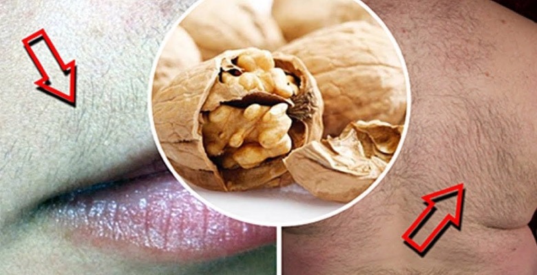 ceviz-kabugu-kuru-ile-istenmeyen-tuylerden-kurtulun-1