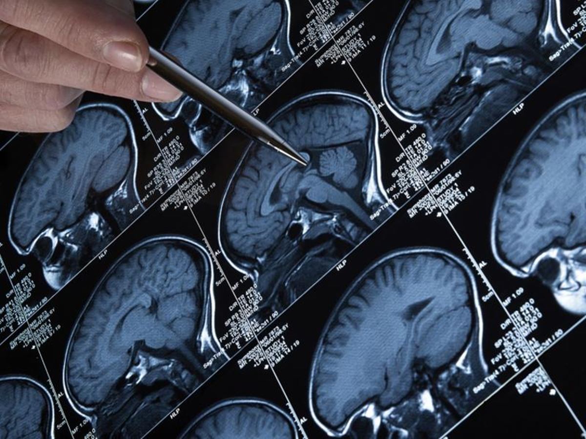 sag-sol-ayrimi-nasil-anlasilir-5