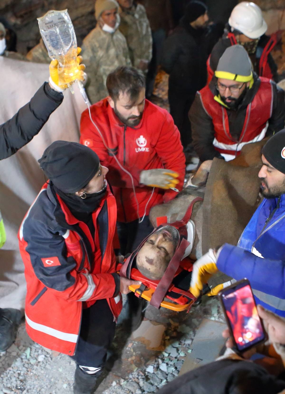 crush-sendromu-belirtileri