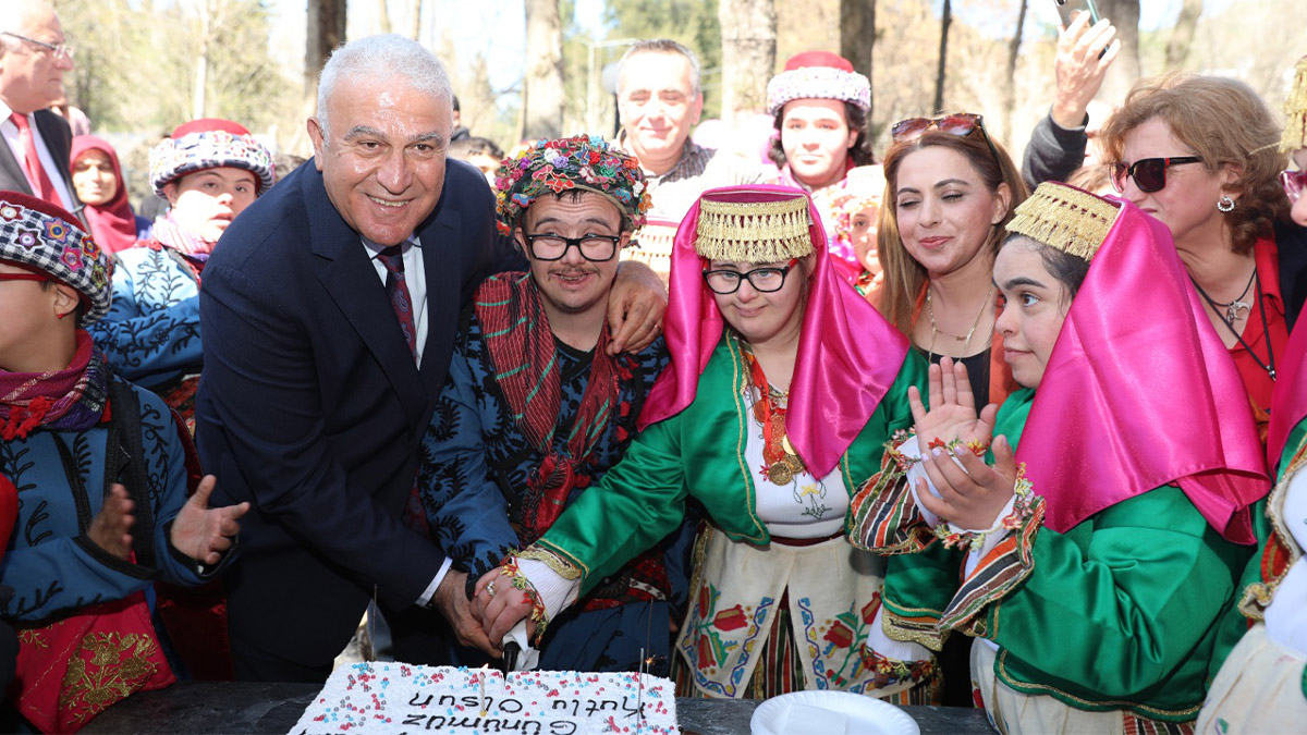 down-sendrom-baskan-atay-5