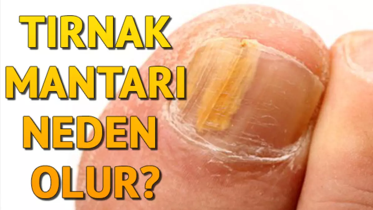 5b4f354f5379ff1e9c2814c0