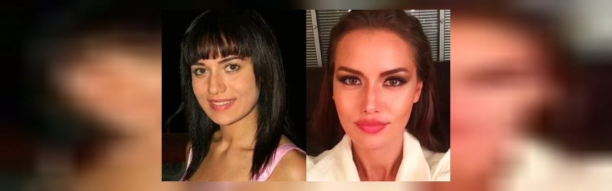 Fahriye Evcen Estetik