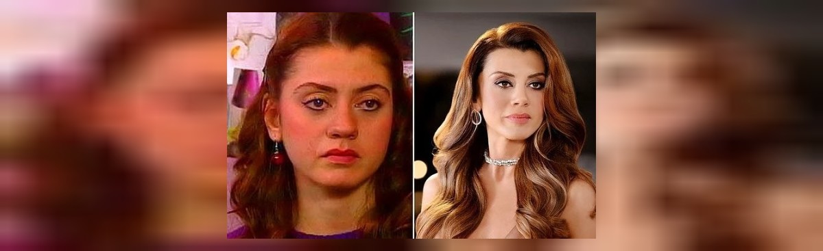 Gökçe Bahadır Estetik