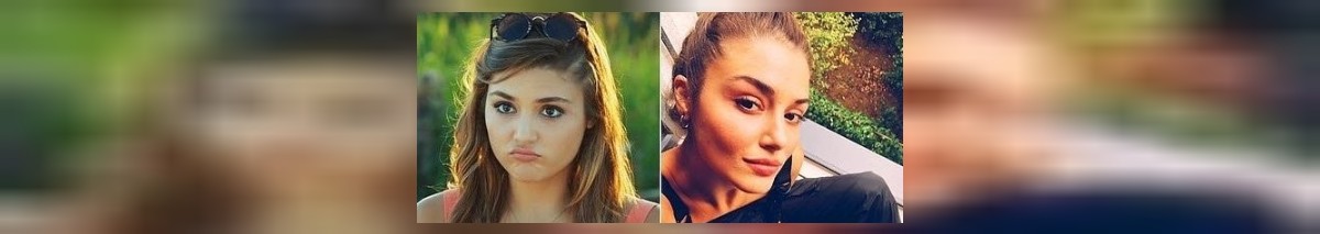 Hande Erçel Estetik