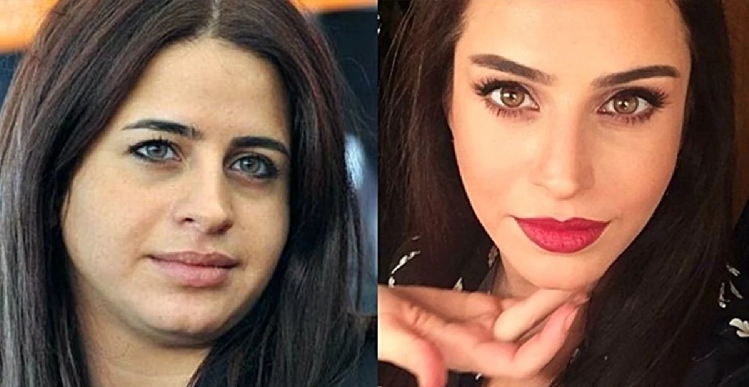 Büşra peki estetik