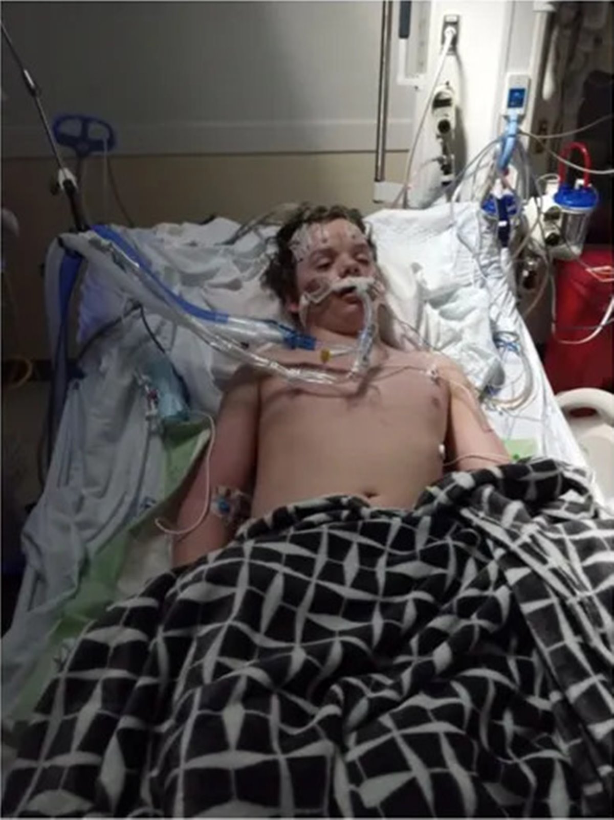 justin-stevens-benadryl-challenge-1