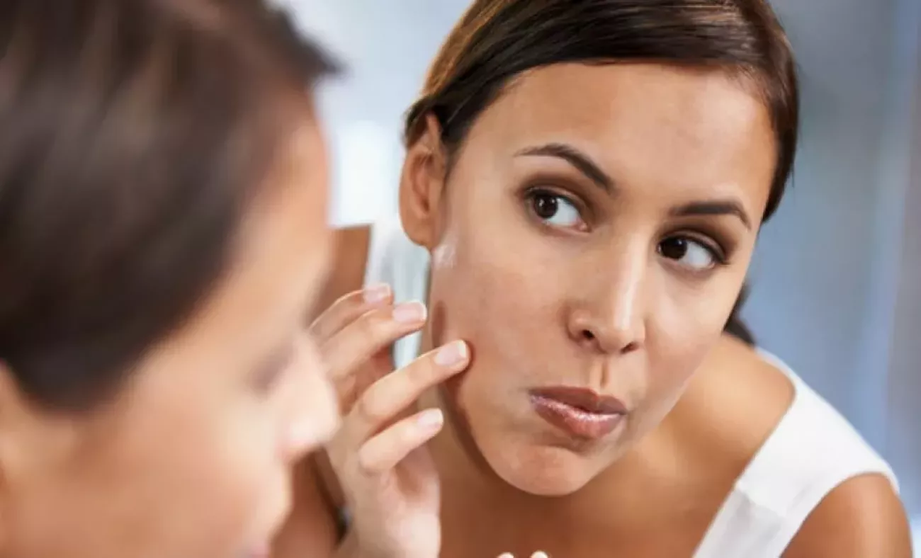 yuzdeki-tuyler-neden-cikar-yuzdeki-tuyler-nasil-gider-1553257061-8303