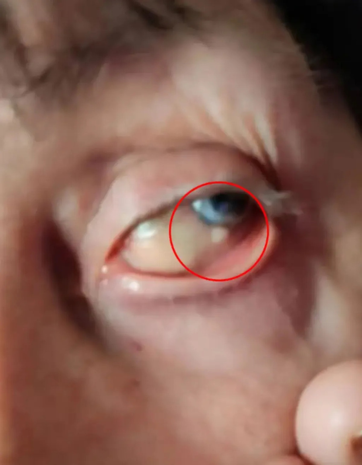 gozunde-tasla-yasayan-kadin-2