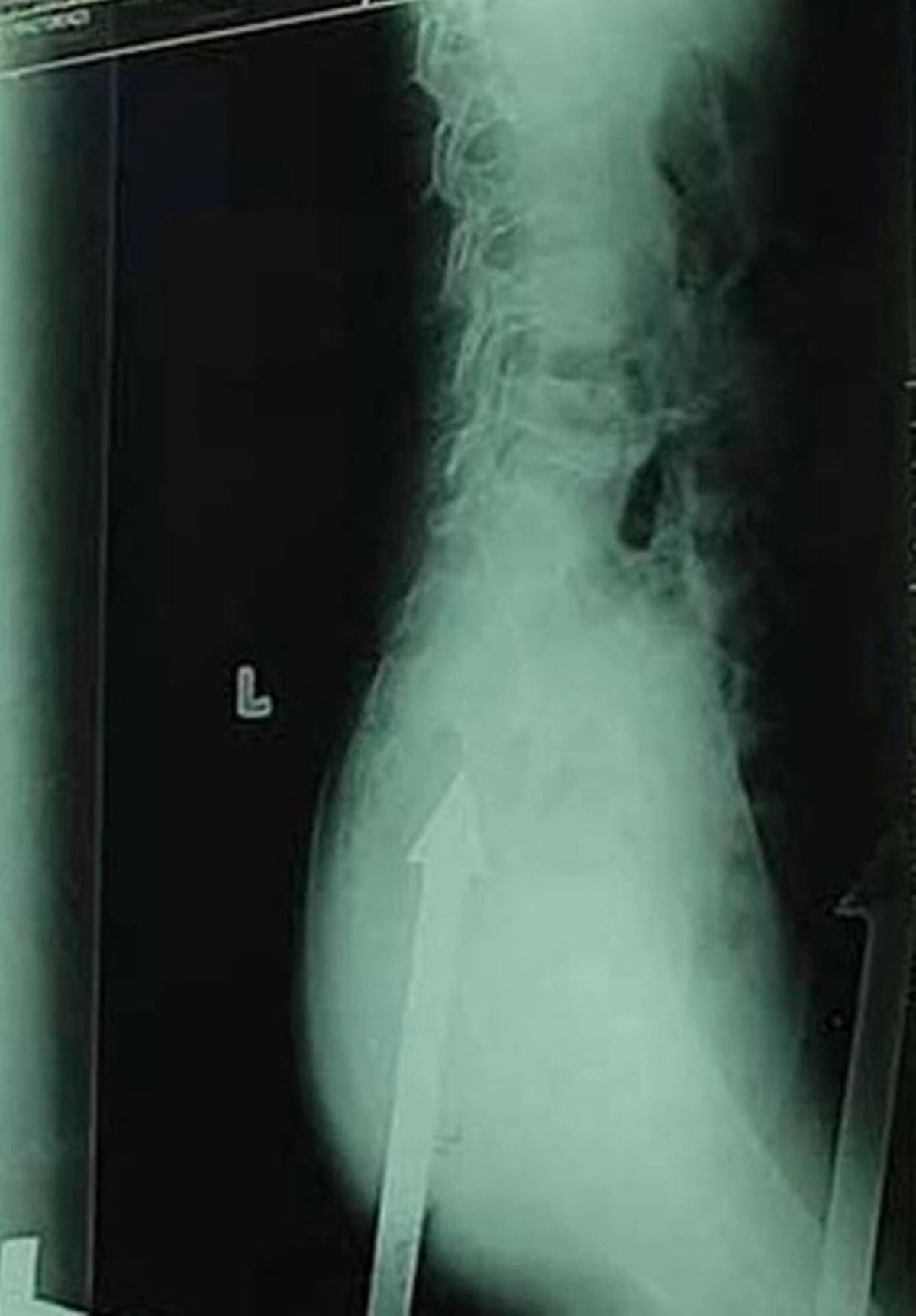 demir-korkuluklara-saplanan-cocuk-1