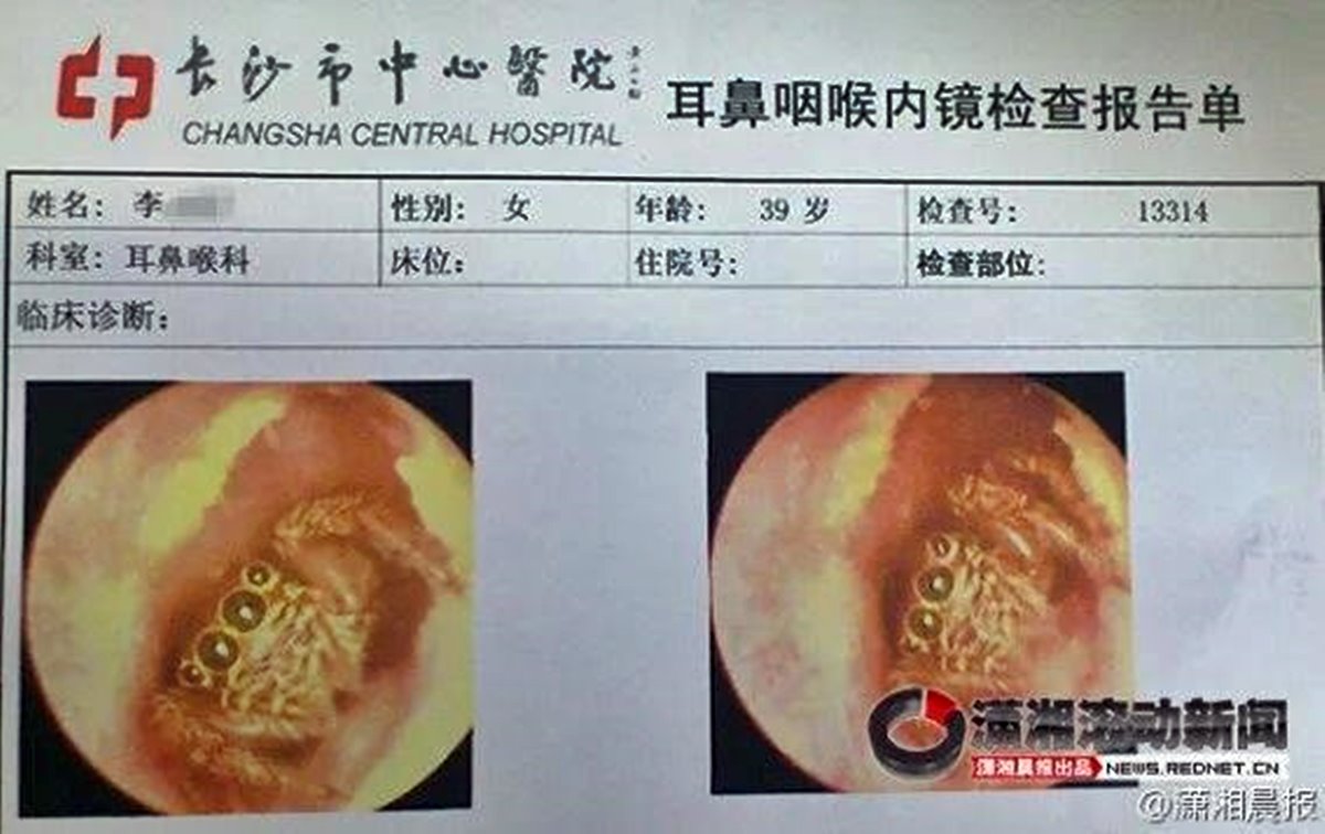 kulagin-icinde-yasayan-bocekler