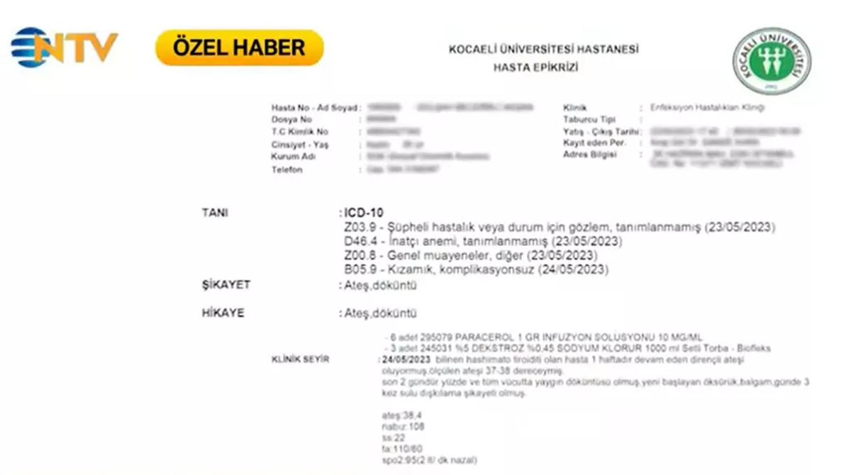 35-yasinda-kizamik-oldu-2