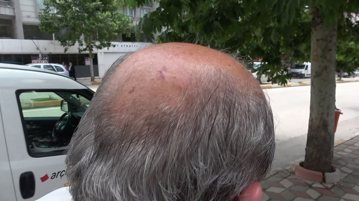 tokatta-insanlara-saldiran-karga-8