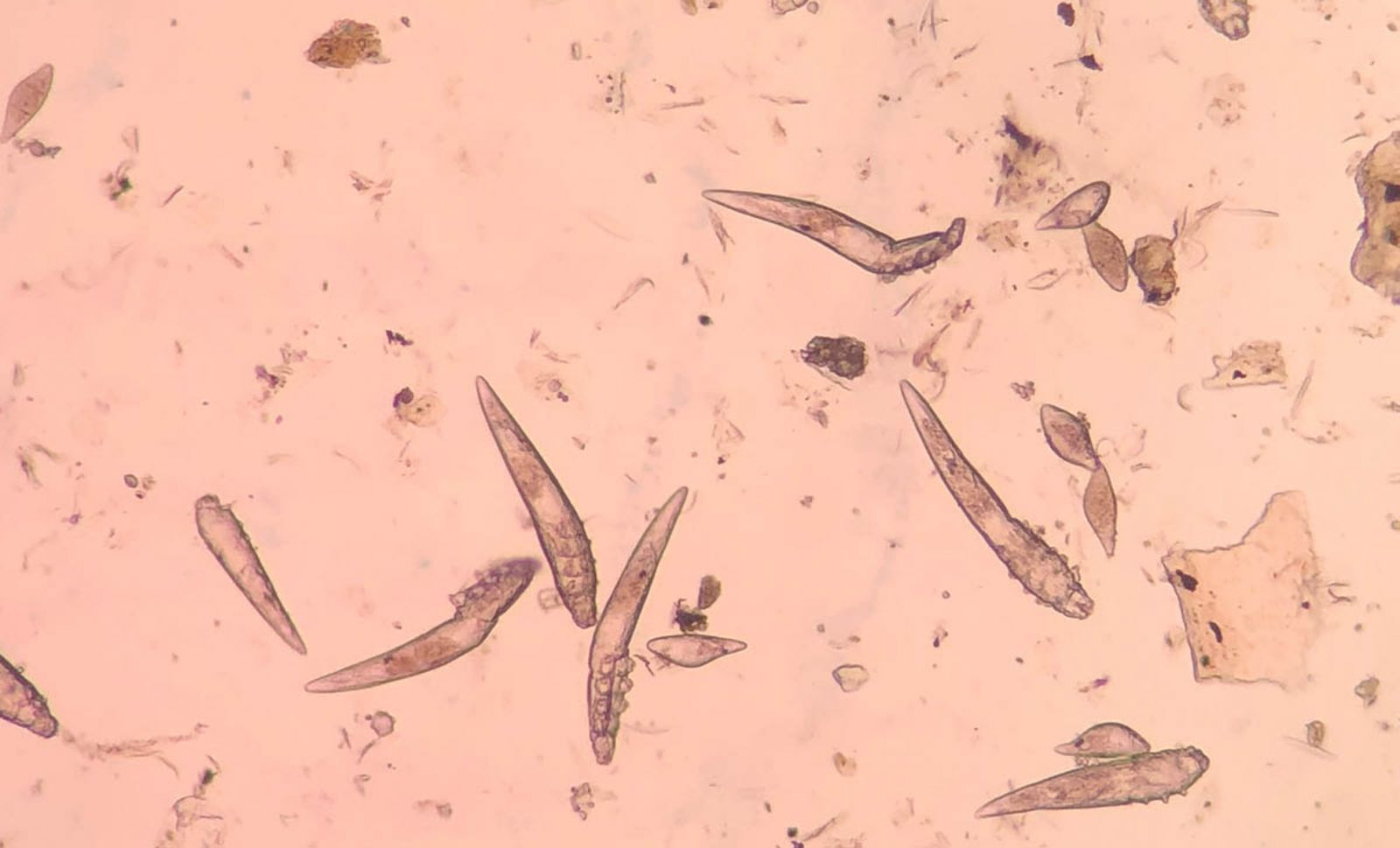 demodex-nedir-zarar-li-nasil-temizlenir-2