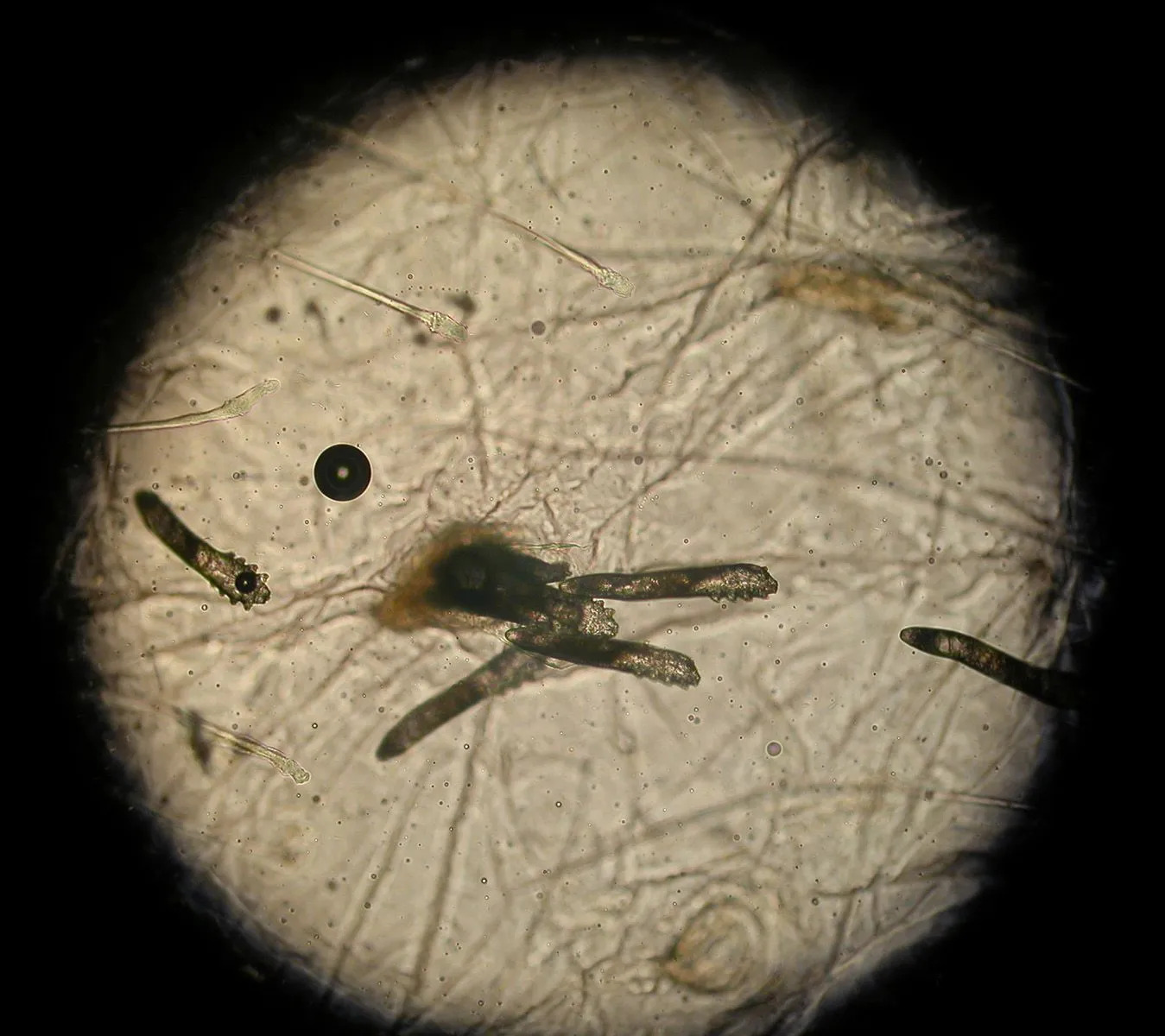 demodex-nedir-zarar-li-nasil-temizlenir-3