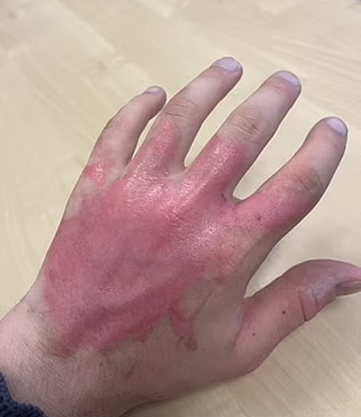 yaban-maydanozune-degen-cocugun-eli-sisti-1